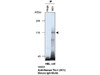 Tie-1 (9C1) Anti-Human Mouse IgG MoAb