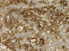 C-ERC/Mesothelin (22A31) Anti-Human Mouse IgG MoAb