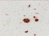 Amyloid Beta ( 35-40 ) ( 1A10 ) Aβ Anti-Human Mouse IgG MoAb