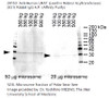 LRAT (Lecithin Retinol Acyltransferase) (031) Anti-Human Rabbit IgG A.P. (Affinity Purify)