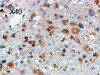 IDH1 R132S (SMab-1) Anti-Human Mouse IgG MoAb 1