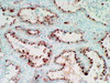 Napsin A (TMU-Ad02) Anti-Human Mouse IgG MoAb 1