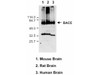 Anti-Human BACE (C) Rabbit IgG Affinity Purify 1