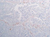 Nestin (N1602) Anti-Human Rabbit IgG Affinity Purify 1