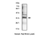 CD20 (N) (4-6H:2C) Anti-Human Mouse IgG MoAb 1