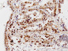 Anti-TP (ATYMPMAB) Mouse IgG MoAb 1