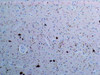 Tau Anti-Human Rabbit IgG Affinity Purify 1