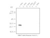 14-3-3τ Protein (33A) Anti-Human Mouse IgG MoAb