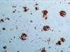 Amyloid Beta ( 11-28 ) ( 12B2 ) Aβ Anti-Human Mouse IgG MoAb