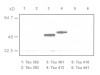 τ/E2 Junction (1A1) Anti-Human Mouse IgG MoAb