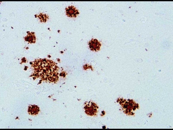 Amyloid β (N) Anti-Human Rabbit IgG Affinity Purify, 18584
