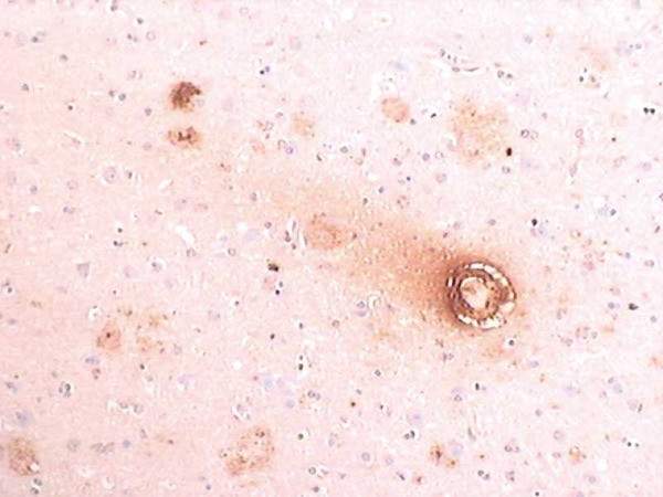 Amyloidβ (1-40) Anti-Human Rabbit IgG Affinity Purify - 50 µg