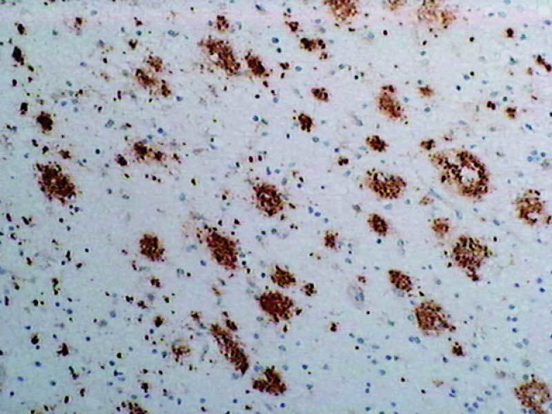 hn2点 Amyloidβ (N3pE) Anti-Human Rabbit IgG Affinity Purify - 50 µg