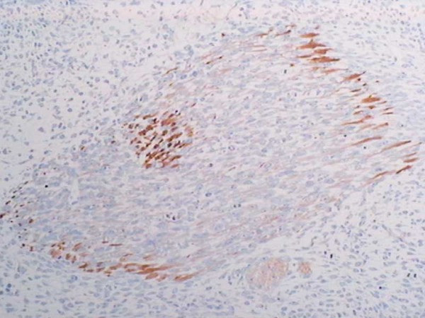 Nestin (N1602) Anti-Human Rabbit IgG Affinity Purify, 18741-S