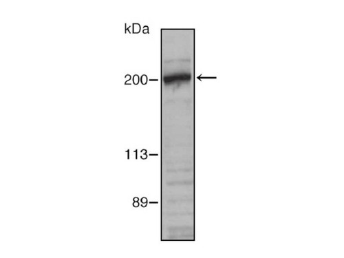 Nestin (N1602) Anti-Human Rabbit IgG Affinity Purify, 18741