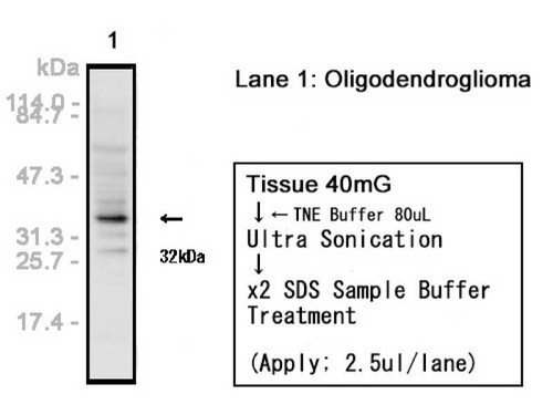 Nestin (N1602) Anti-Human Rabbit IgG Affinity Purify, 18741