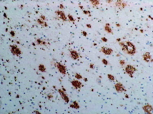 Amyloidβ (1-40) Anti-Human Rabbit IgG Affinity Purify - 50 µg