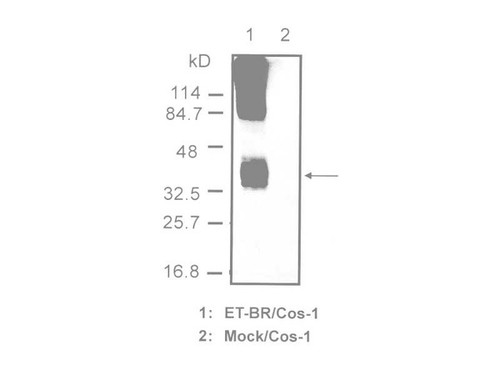 Endothelin-B Receptor (8Z11) Anti-Human Mouse IgG MoAb 1