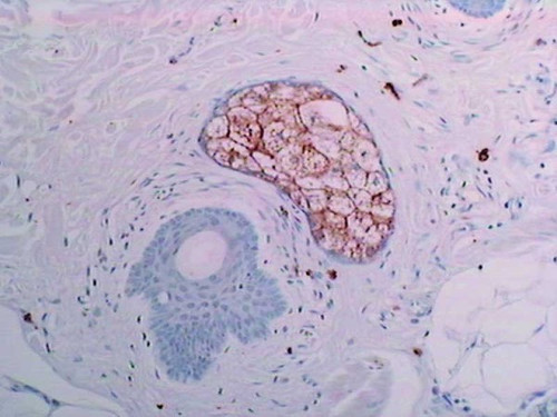 FAS (14G5) Anti-Human Mouse IgG MoAb 1