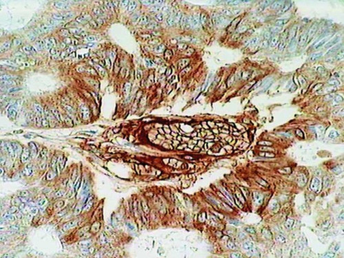 VEGF (R11) Anti-Human Mouse IgG MoAb 1