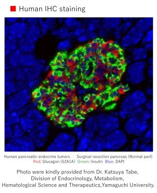 Anti-Glucagon (52A1A) Rat IgG MoAb 1