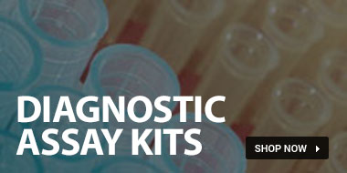 home-diagnostic-assays.jpg