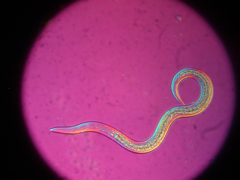 What's the difference between Parasitic and Beneficial Nematodes?
