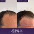 Caudalie Anti-Hair Loss Serum 50ml