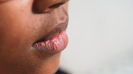 Why are my lips so dry?