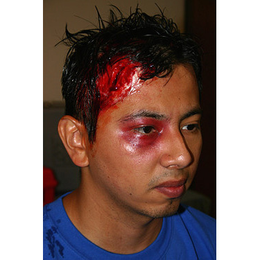 Simulaids 880 Moulage Movie