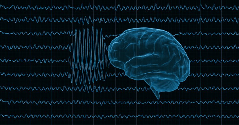 EEG Tests Can Confirm Photosensitive Seizure Activity in the Brain EEG Scan of Photosensitive Seizure Activity in Brain