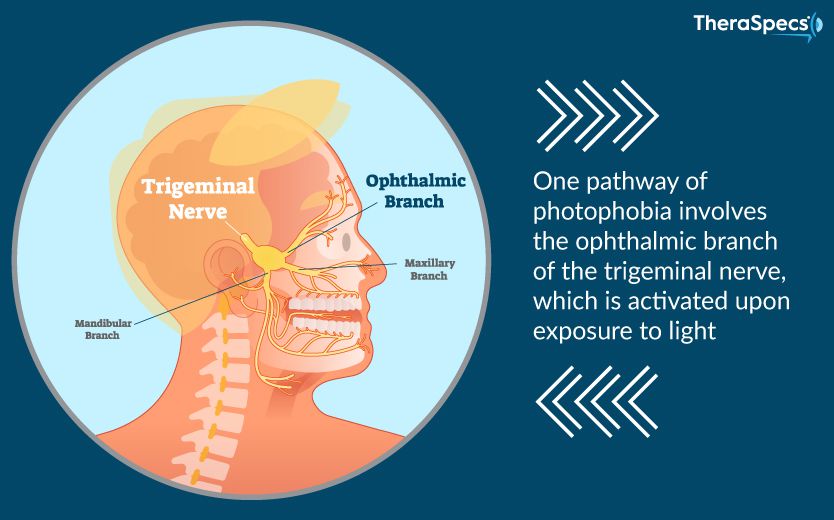 Trigeminal Nerve, one pathway for photophobia