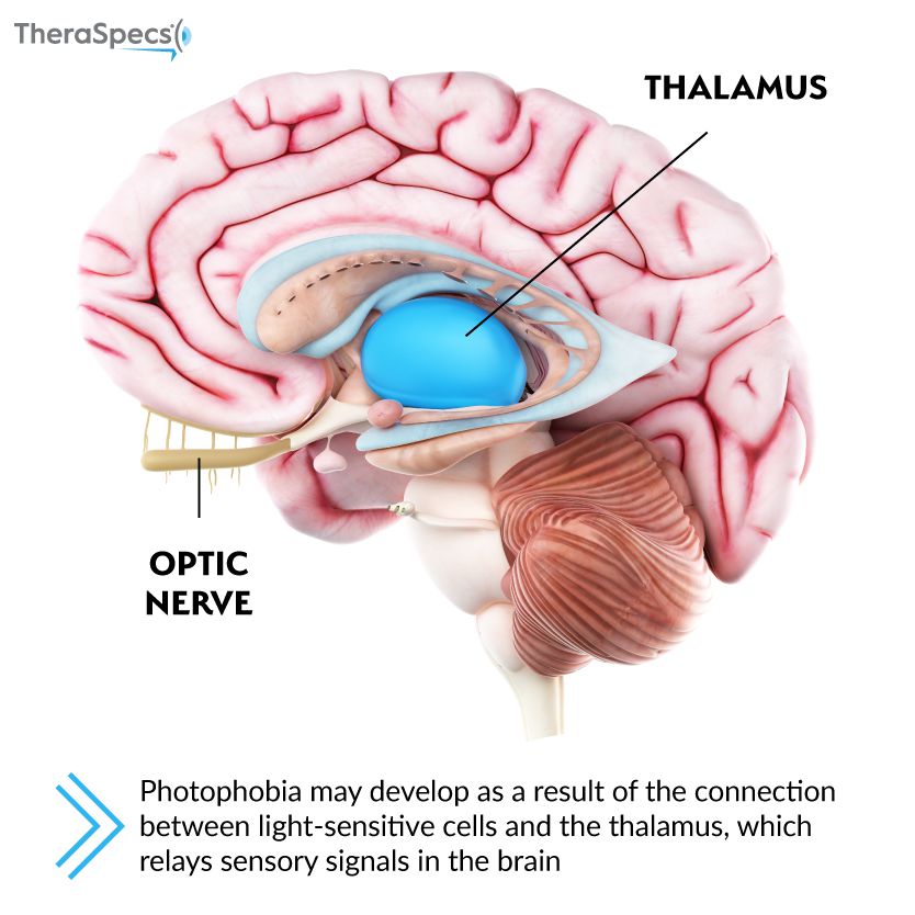 Diagram of Thalamus in the Brain Thalamus, another pathway for photophobia