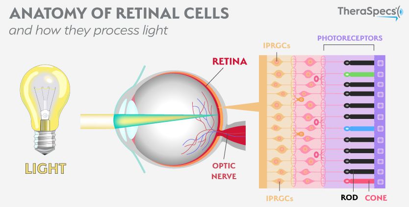 Diagram of Retinal IPRGC cells Retinal IPRGC cells activate photophobia