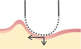 Electric shaver cutting hair beneath a perforated foil