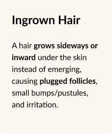 ingrown hair