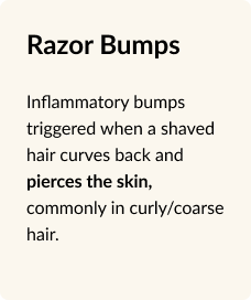 rzaor bumps