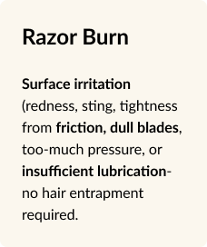 rzaor burns