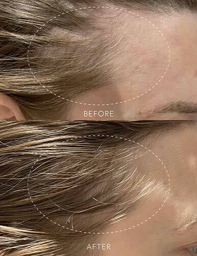 DISCOVER: GROWTH CYCLE HAIR SUPPLEMENT