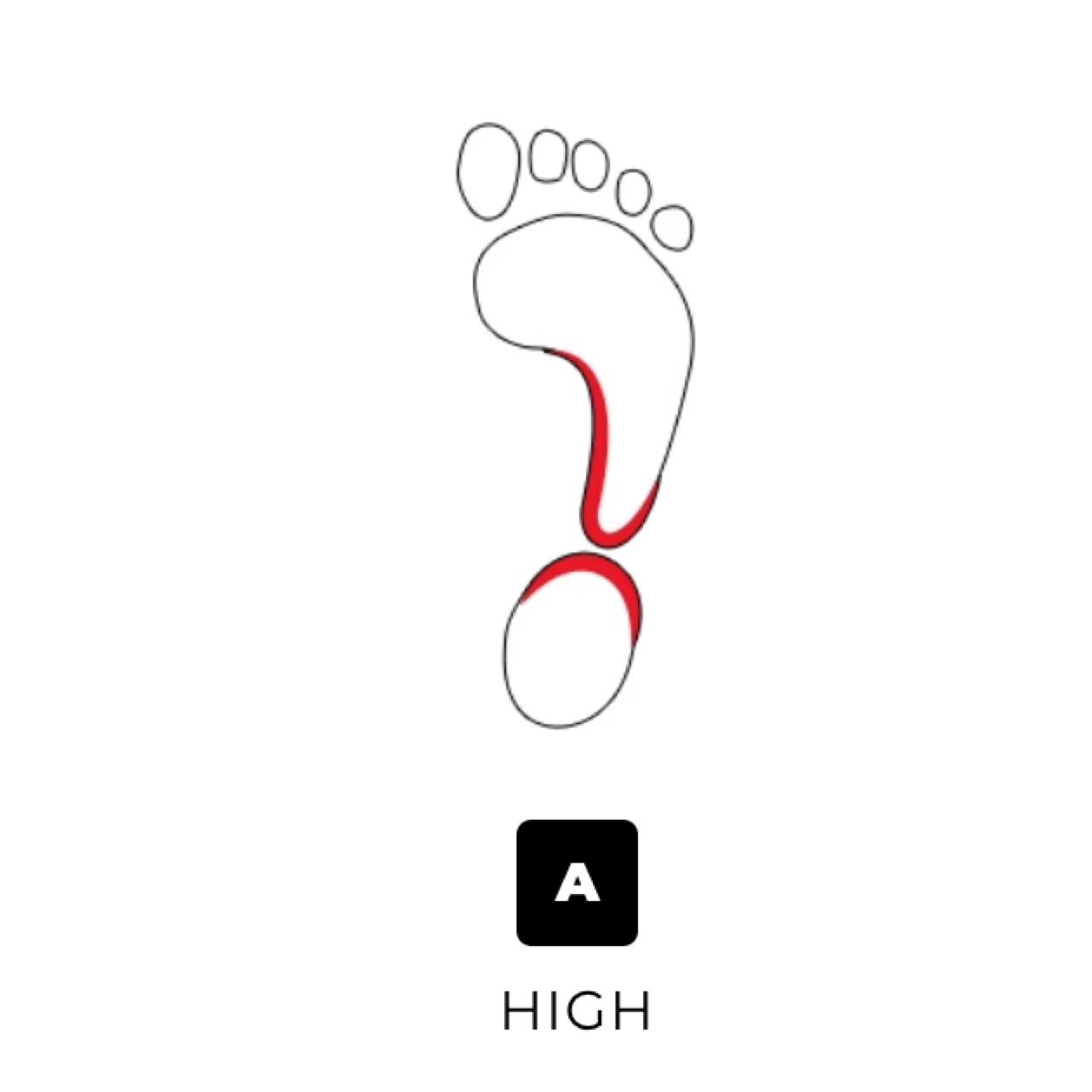 High Arch