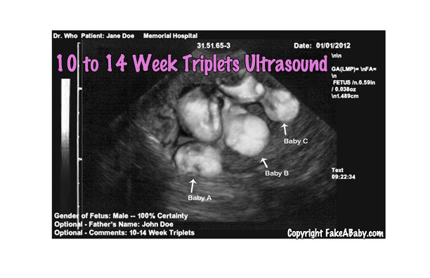 april fools fake sonogram