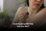 Could Applying CBD Help with Itchy Skin?
