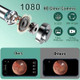 Wireless WiFi Earwax Remover with 1080P HD Camera and 6 LEDs, IP67 Waterproof, for iOS and Android