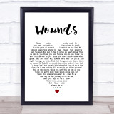 Empire Cast Wounds White Heart Song Lyric Print