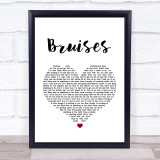 Lewis Capaldi Bruises White Heart Song Lyric Quote Print