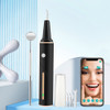 Sonic Tartar Removing Dental Scaler