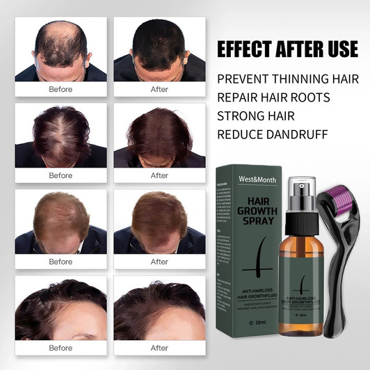 30ml Hair Beard Growth Roller Set Beard Oil Spray-818