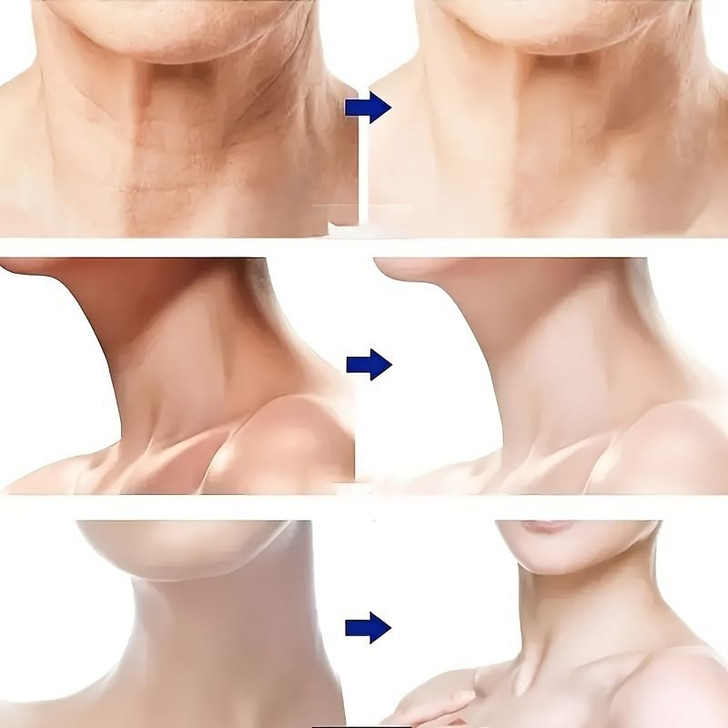 ES-1081 Skin Rejuvenation Beauty Device For Face And Neck. Based On Triple Action LED