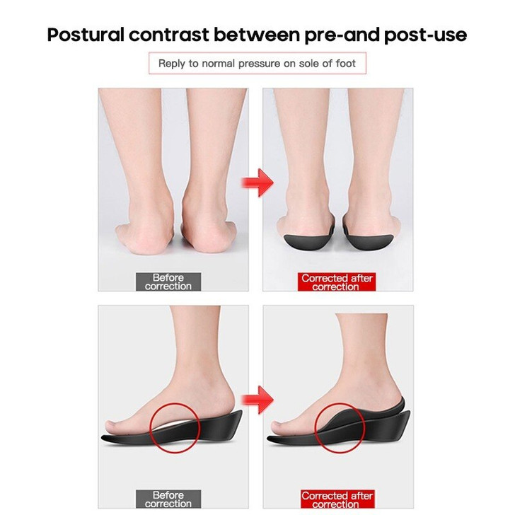 Orthotic Insole O-shaped Leg Flatfoot Corrector Shoe Pad