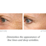 Lumetrics with Copuline gives you brighter, smoother, more youthful looking skin.